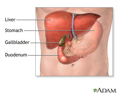 Gallbladder removal open Information Mount Sinai New York