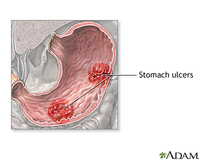 The Stomach Series