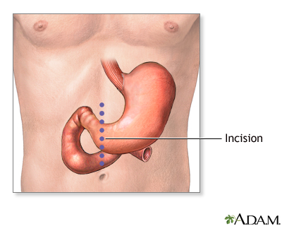 The Stomach Series