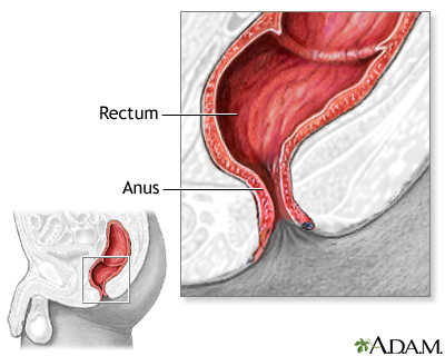 normal anus bumps