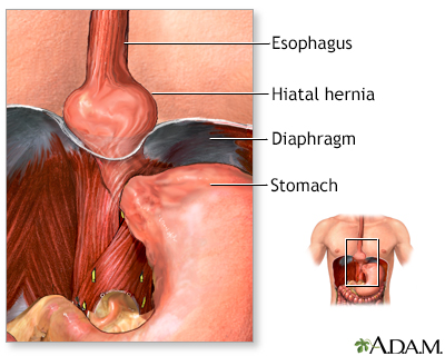 can dogs have hiatal hernias