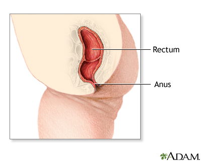 Imperforate anus repair - series - Presentation Thumbnail              