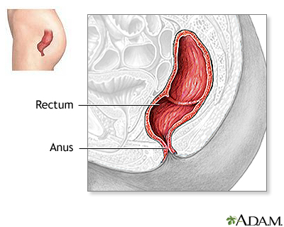 Locations of the rectum in the pelvic cavity and of the normal