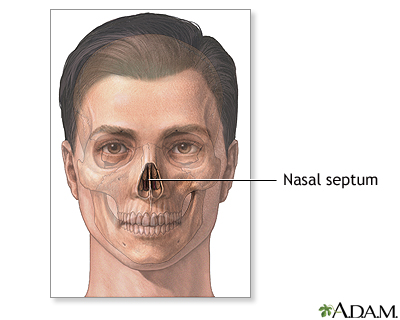 Septoplasty - series - Septal anatomy