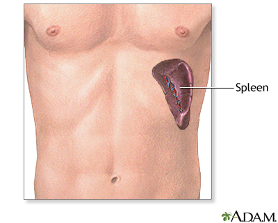 Spleen removal - series - Presentation Thumbnail
                    