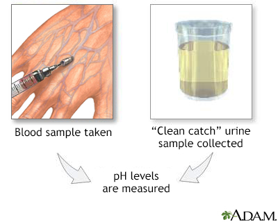 PH urine test
