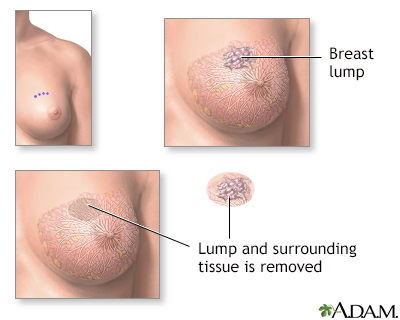 breast  Taber's Medical Dictionary