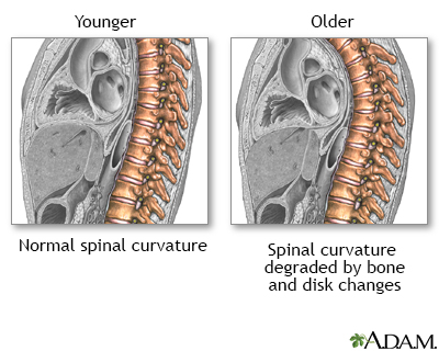 A DEXA Scan can put you on the path to stronger bones