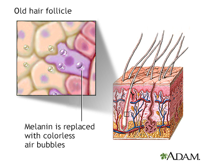 Aged hair follicle - Illustration Thumbnail
              