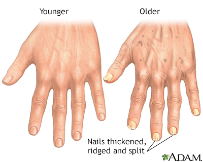 Aging changes in nails - Illustration Thumbnail
              