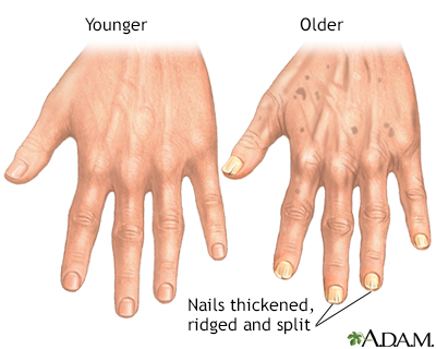 Aging changes in nails - Illustration Thumbnail
                      