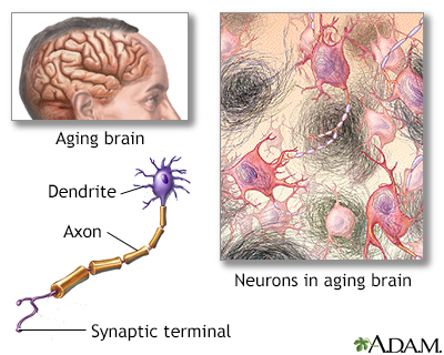 Aged nervous tissue - Illustration Thumbnail
                      