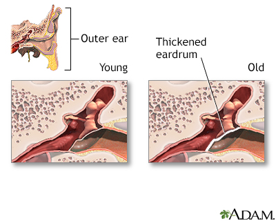 Aging changes in hearing - Illustration Thumbnail
              