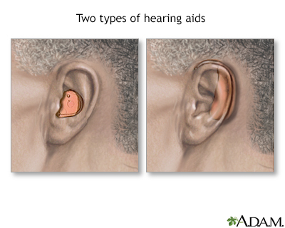 Hearing aids