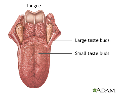 Geographic tongue Information  Mount Sinai - New York