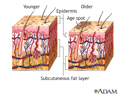 Changes in skin with age