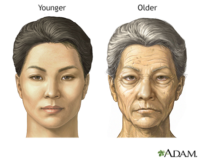 Aging changes in skin Information | Mount Sinai - New York