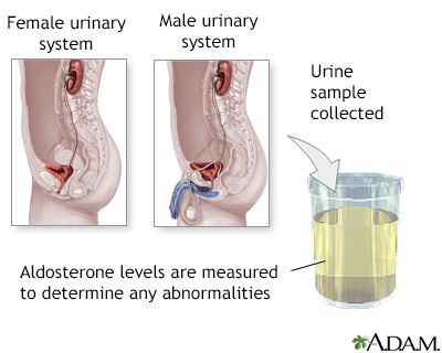 Aldosterone level test - Illustration Thumbnail
              