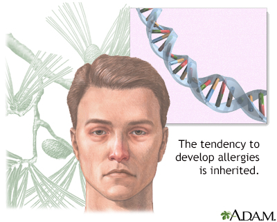 Why Does Pollen Cause Allergies?  New York Allergy and Sinus Centers