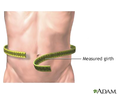 Abdominal girth measurement - Illustration Thumbnail
                      