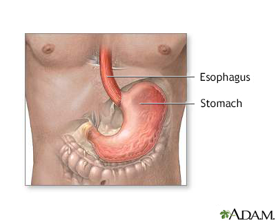 Stomach and stomach lining - Illustration Thumbnail
              