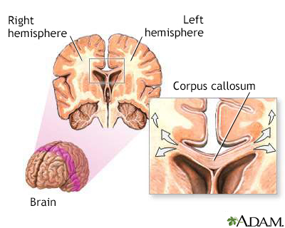 Corpus callosum of the brain - Illustration Thumbnail              