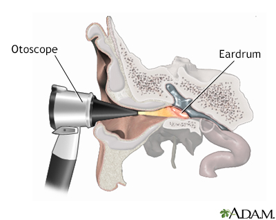 Otoscope examination