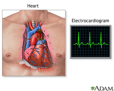 Électrocardiogramme (ECG)