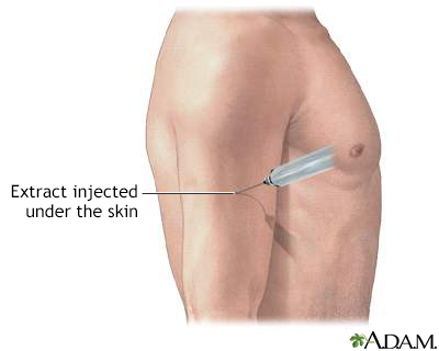 Antigen injection - Illustration Thumbnail
                      