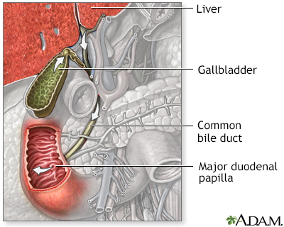 Pancreatic duct obstruction