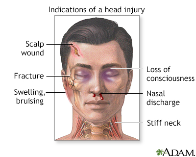 head injury aid hemorrhage closed