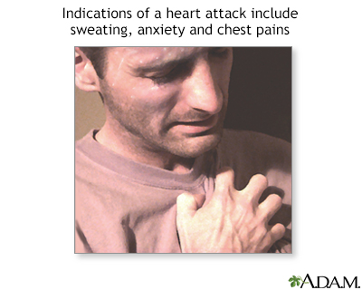 Symptoms of heart attack - Illustration Thumbnail
              