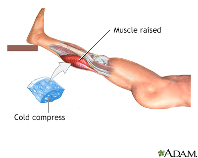 Treatment for leg strain - Illustration Thumbnail
                      