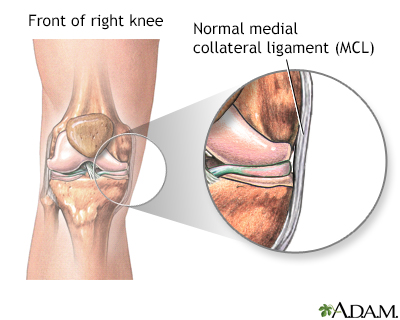 MCL Cluster  Diagnosting Medial Collateral Ligament Injuries