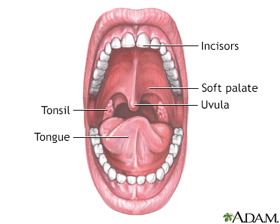 oral thrush after antibiotics