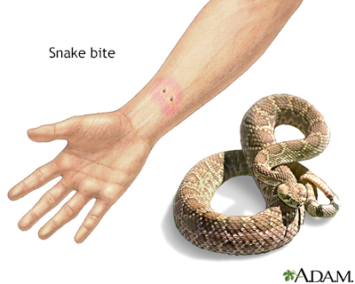 What Causes A Snake To Bite - Snake Poin