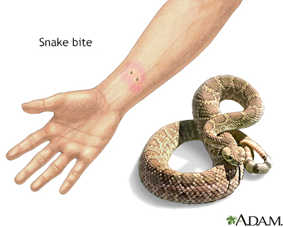 Snake bite - Illustration Thumbnail
                      