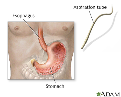 gastric acid