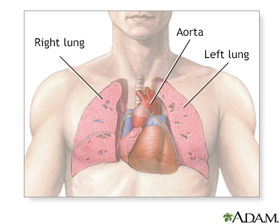 Female chest and abdominal muslces, pink x-ray frontal view