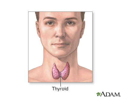 hyperthyroidism face