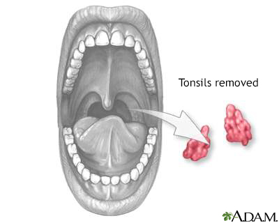 does a dog have tonsils