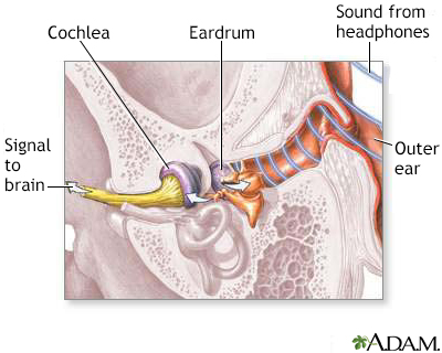 Sound wave transmission - Illustration Thumbnail
                      