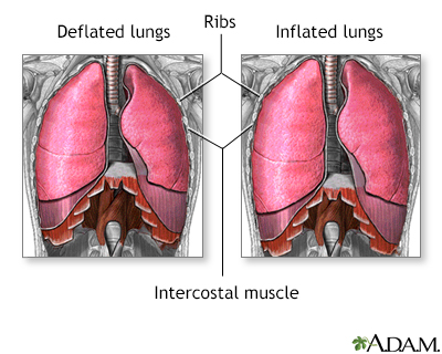 Breathing Difficulty Lying Down Information Mount Sinai New York