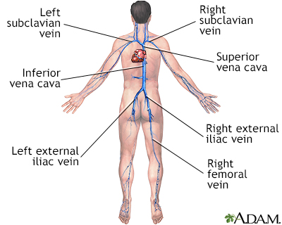 blood clot in upper arm