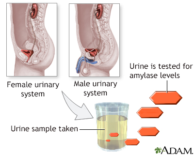 Amylase urine test - Illustration Thumbnail
              