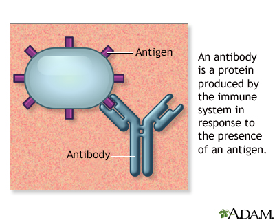 Systemic lupus erythematosus Information