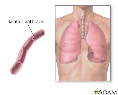 Bacillus anthracis - Illustration Thumbnail
              