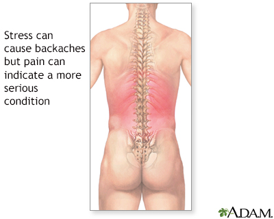 Low back pain - acute Information