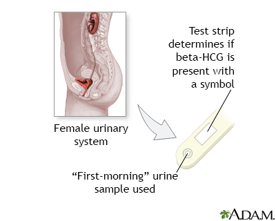 Pregnancy test - Illustration Thumbnail
                      