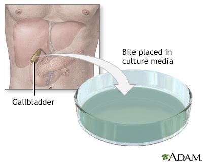 Bile culture - Illustration Thumbnail
              